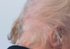 Trump calvitie