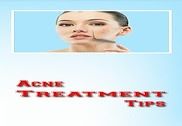 Acne Removal & Treatment Tips Education