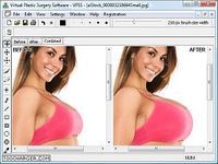 Virtual Plastic Surgery Software Virtual Plastic Surgery Software