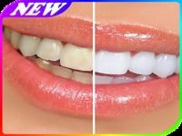 Tips Cara Memutihkan Gigi Tips Cara Memutihkan Gigi
