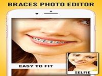 Braces 2.0 Braces 2.0