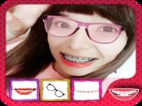 Braces Teeth Beauty Camera Braces Teeth Beauty Camera