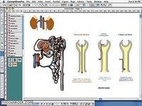 ConceptDraw MEDICAL ConceptDraw MEDICAL