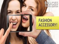Braces on Photo. Editor Braces on Photo. Editor